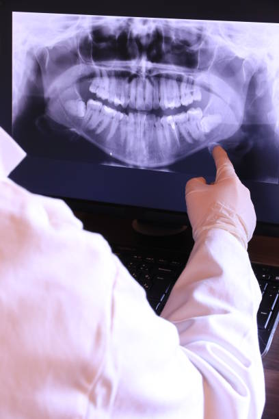 Best Cracked Tooth Emergency Dentist  in California, MO