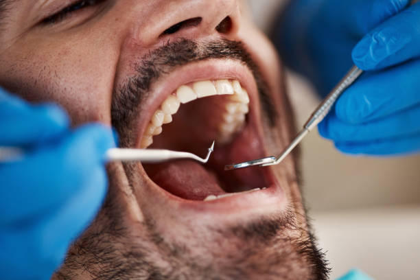 Best Cracked Tooth Emergency Dentist  in California, MO