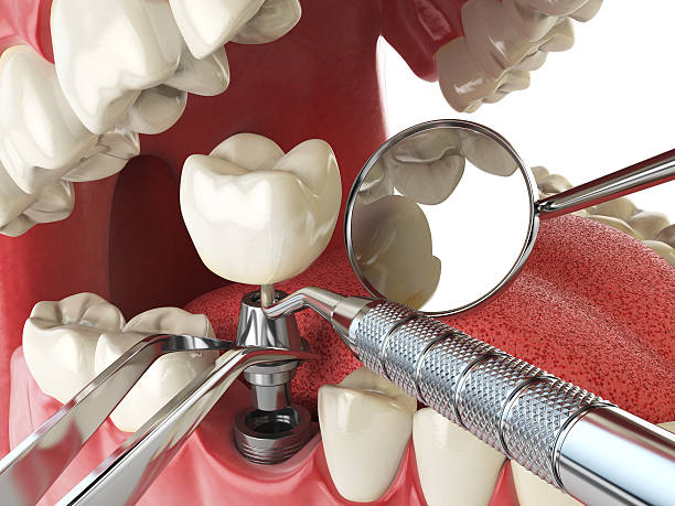 Reliable MO Emergency Dentist Solutions